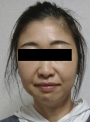 After image