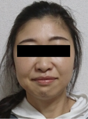 Before image